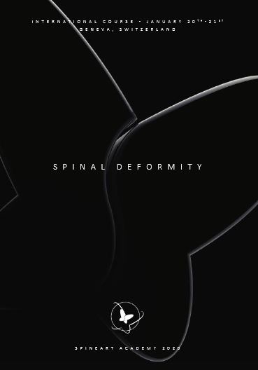 Cartel Spinal Deformity 2020